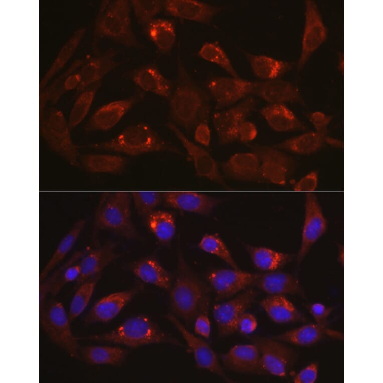 Immunofluorescence - Anti-LAMP1 Antibody (A87605) - Antibodies.com