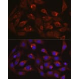 Immunofluorescence - Anti-LAMP1 Antibody (A87605) - Antibodies.com
