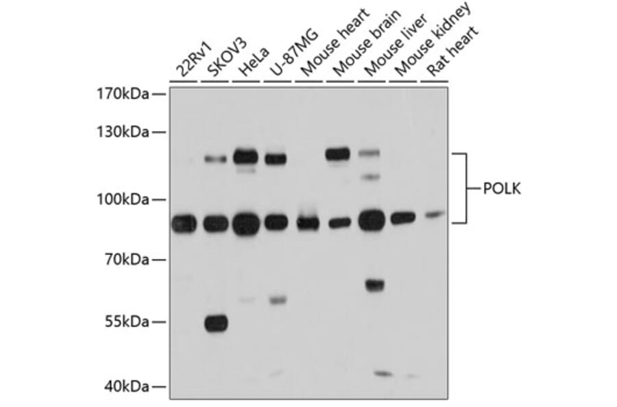 Western Blot - Anti-DNA Polymerase Kappa / POLK Antibody (A87606) - Antibodies.com