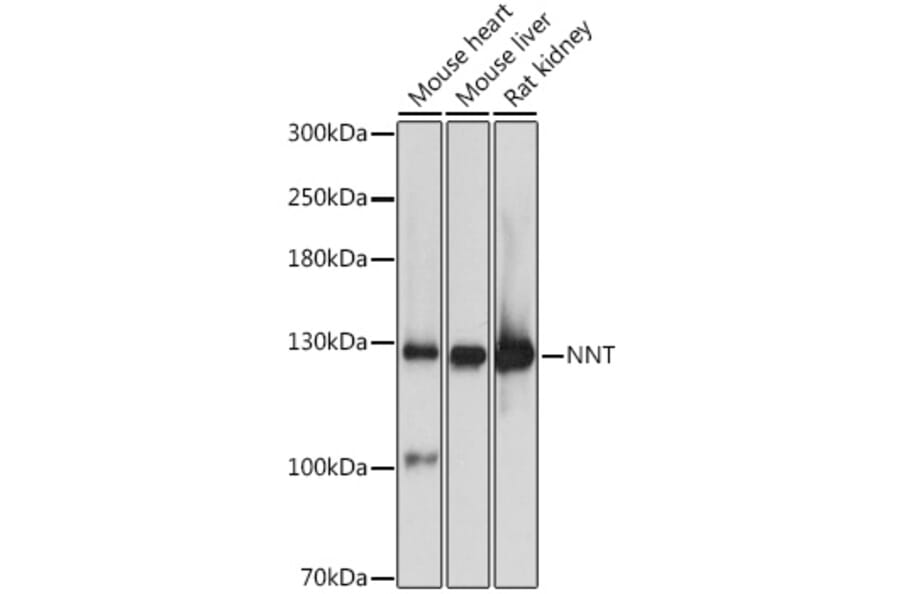 Western Blot - Anti-NNT Antibody (A87607) - Antibodies.com