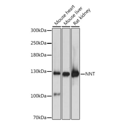 Western Blot - Anti-NNT Antibody (A87607) - Antibodies.com