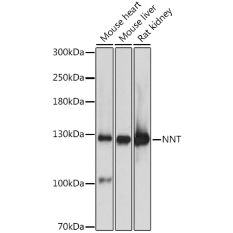 Western Blot - Anti-NNT Antibody (A87607) - Antibodies.com