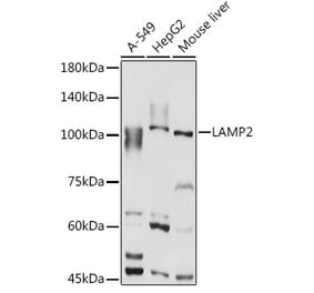 Western Blot - Anti-LAMP2 Antibody (A87608) - Antibodies.com