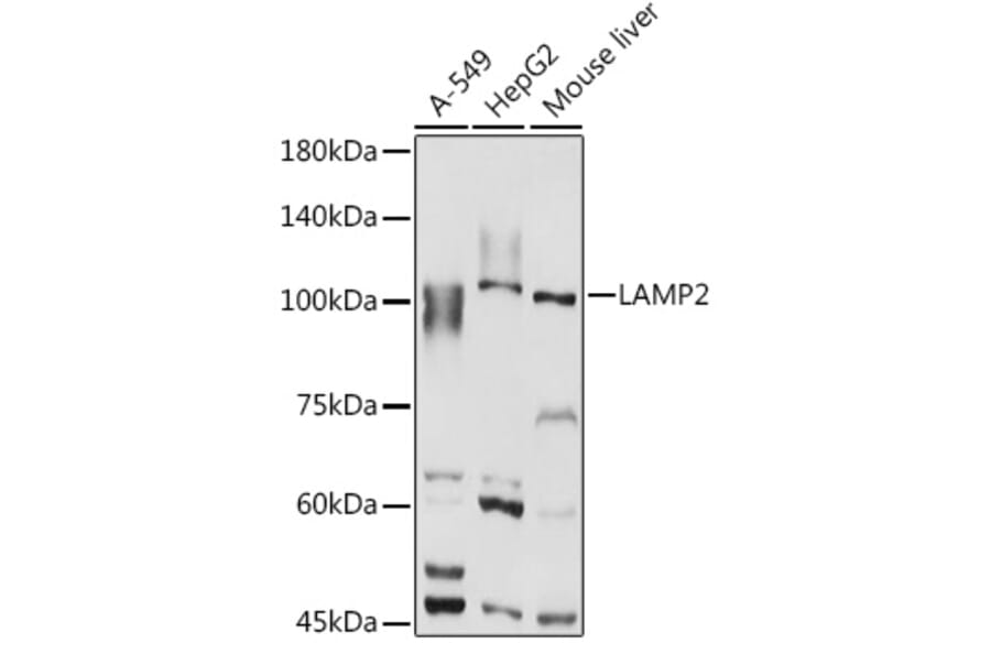 Western Blot - Anti-LAMP2 Antibody (A87608) - Antibodies.com