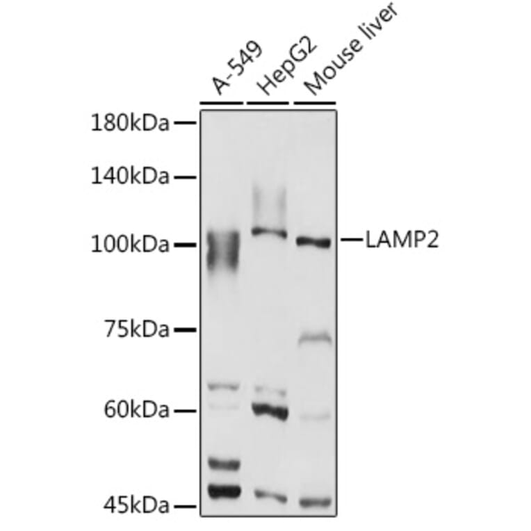 Western Blot - Anti-LAMP2 Antibody (A87608) - Antibodies.com