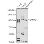 Western Blot - Anti-LAMP2 Antibody (A87608) - Antibodies.com