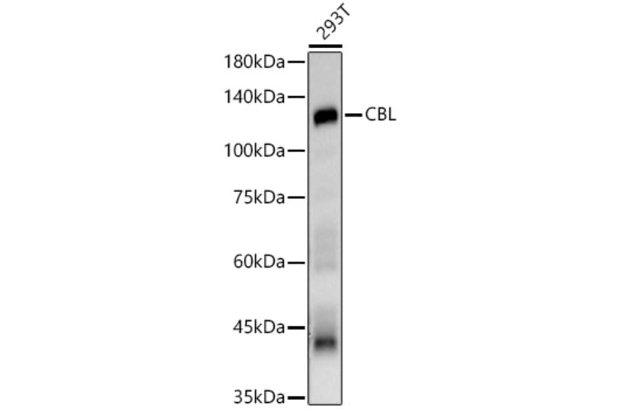 Western Blot - Anti-CBL Antibody (A87609) - Antibodies.com