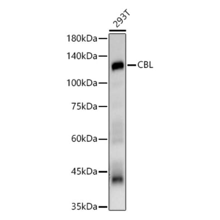 Western Blot - Anti-CBL Antibody (A87609) - Antibodies.com