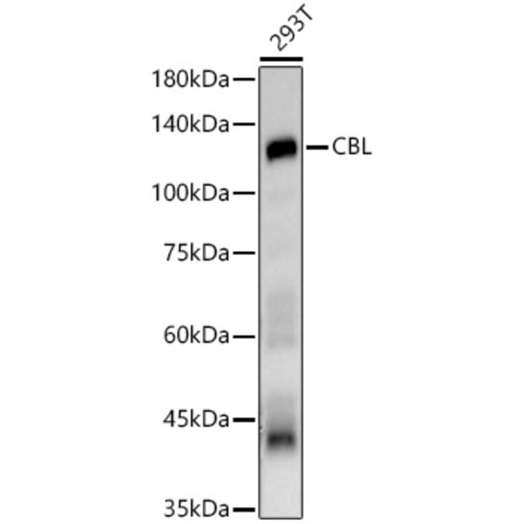 Western Blot - Anti-CBL Antibody (A87609) - Antibodies.com