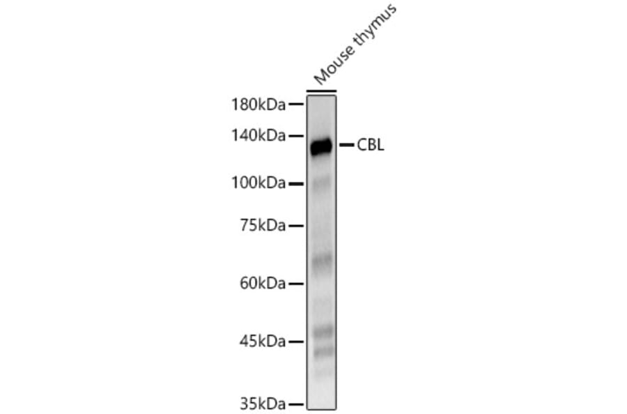 Western Blot - Anti-CBL Antibody (A87609) - Antibodies.com