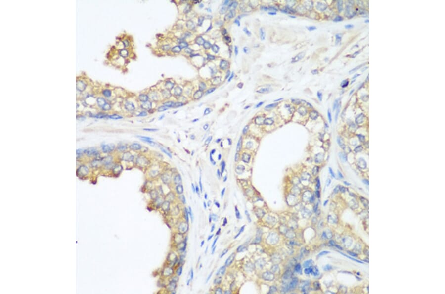 Immunohistochemistry - Anti-CBL Antibody (A87609) - Antibodies.com