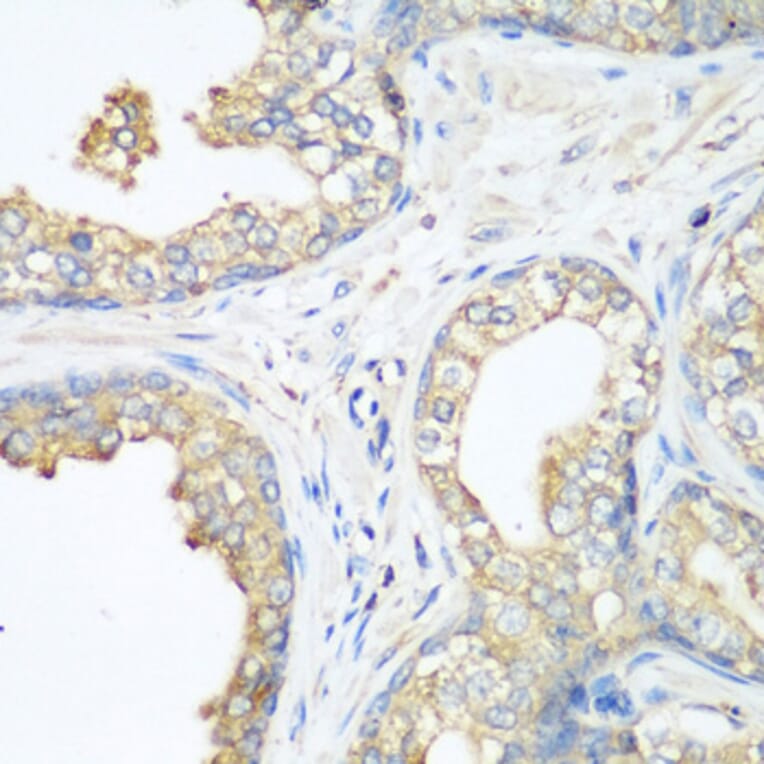Immunohistochemistry - Anti-CBL Antibody (A87609) - Antibodies.com