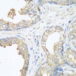 Immunohistochemistry - Anti-CBL Antibody (A87609) - Antibodies.com