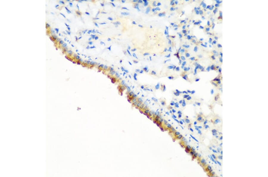 Immunohistochemistry - Anti-CBL Antibody (A87609) - Antibodies.com