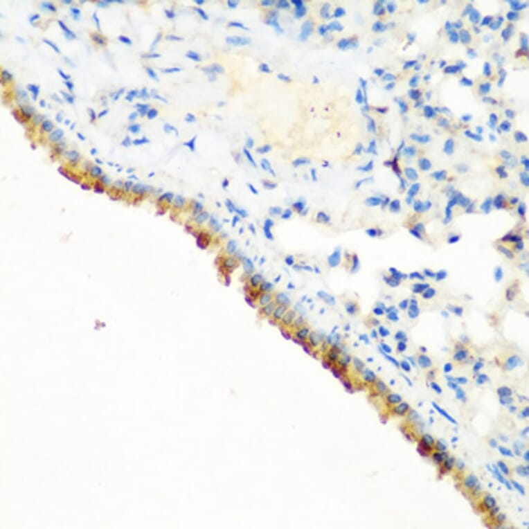 Immunohistochemistry - Anti-CBL Antibody (A87609) - Antibodies.com