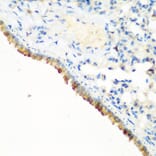 Immunohistochemistry - Anti-CBL Antibody (A87609) - Antibodies.com