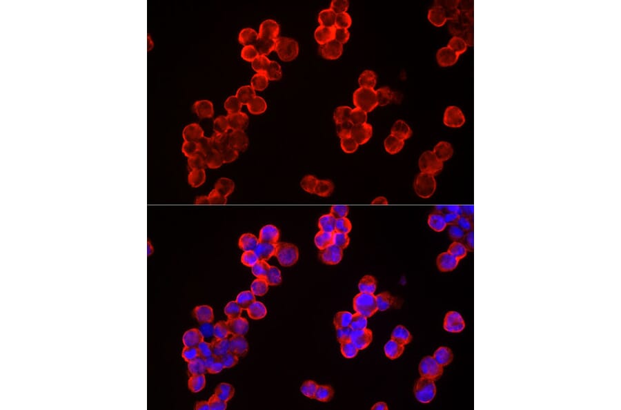 Immunofluorescence - Anti-CBL Antibody (A87609) - Antibodies.com