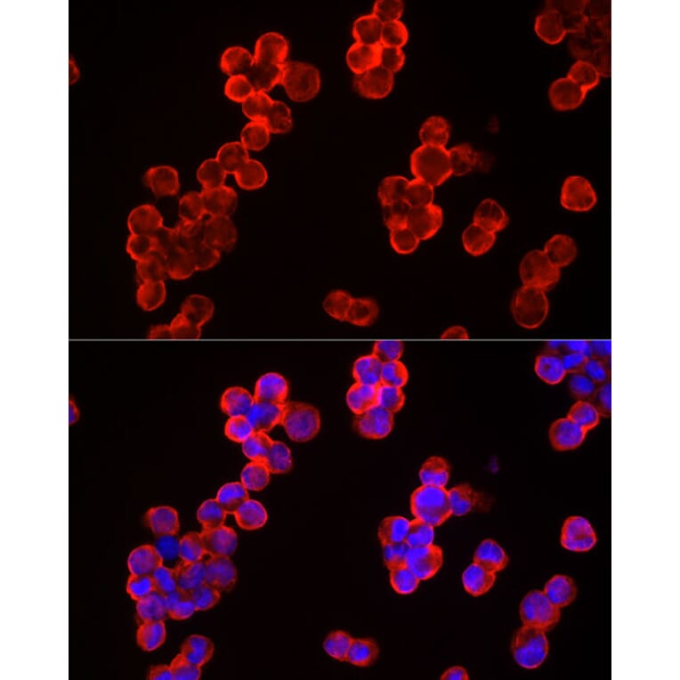 Immunofluorescence - Anti-CBL Antibody (A87609) - Antibodies.com