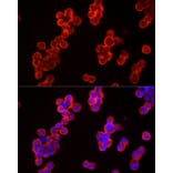 Immunofluorescence - Anti-CBL Antibody (A87609) - Antibodies.com