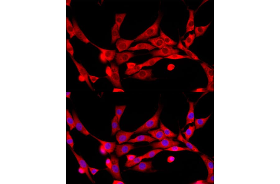 Immunofluorescence - Anti-CBL Antibody (A87609) - Antibodies.com