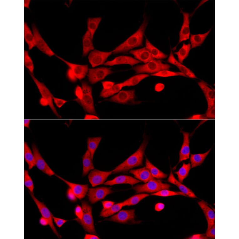Immunofluorescence - Anti-CBL Antibody (A87609) - Antibodies.com