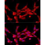Immunofluorescence - Anti-CBL Antibody (A87609) - Antibodies.com