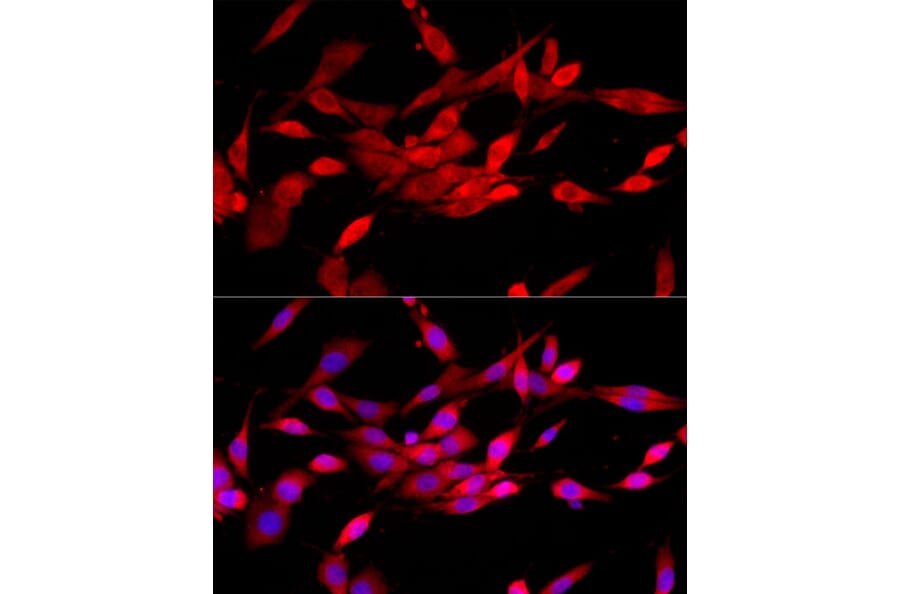 Immunofluorescence - Anti-CBL Antibody (A87609) - Antibodies.com