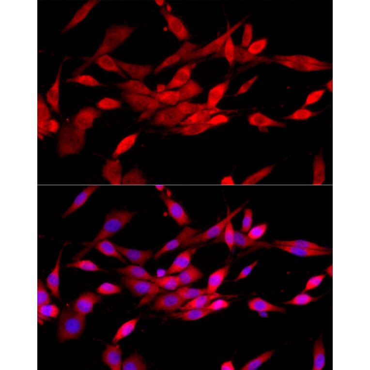 Immunofluorescence - Anti-CBL Antibody (A87609) - Antibodies.com