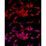 Immunofluorescence - Anti-CBL Antibody (A87609) - Antibodies.com