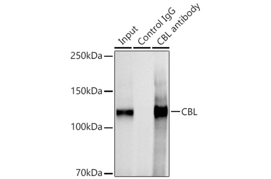 Western Blot - Anti-CBL Antibody (A87609) - Antibodies.com