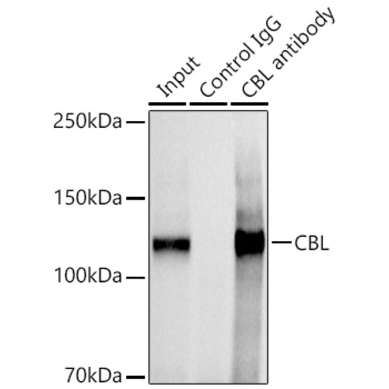 Western Blot - Anti-CBL Antibody (A87609) - Antibodies.com
