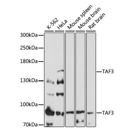 Western Blot - Anti-TAF3 Antibody (A87610) - Antibodies.com