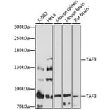 Western Blot - Anti-TAF3 Antibody (A87610) - Antibodies.com