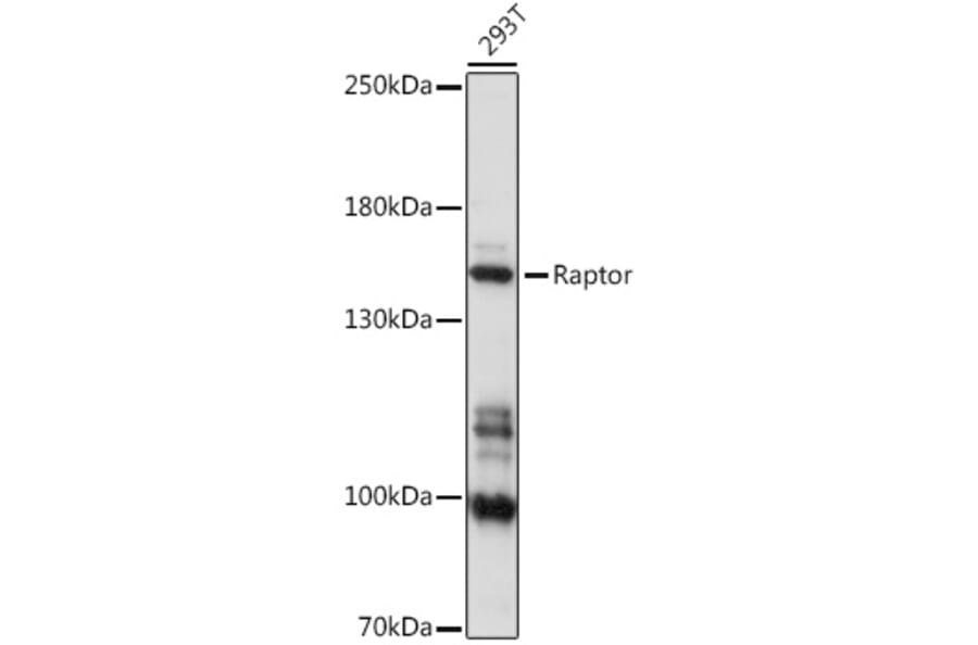 Western Blot - Anti-Raptor Antibody (A87611) - Antibodies.com