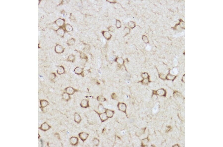 Immunohistochemistry - Anti-Raptor Antibody (A87611) - Antibodies.com