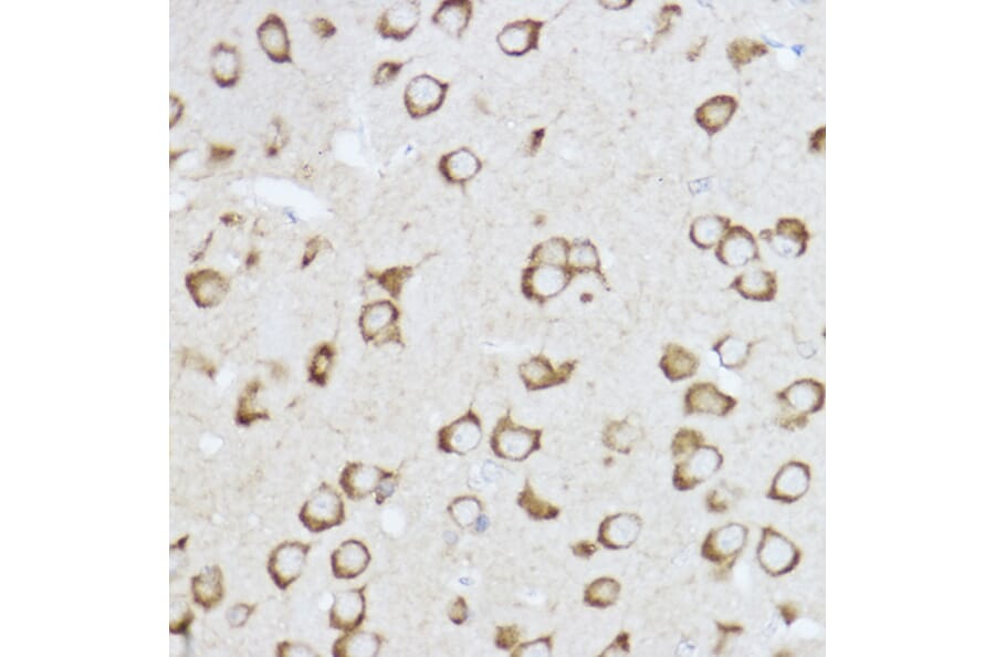 Immunohistochemistry - Anti-Raptor Antibody (A87611) - Antibodies.com