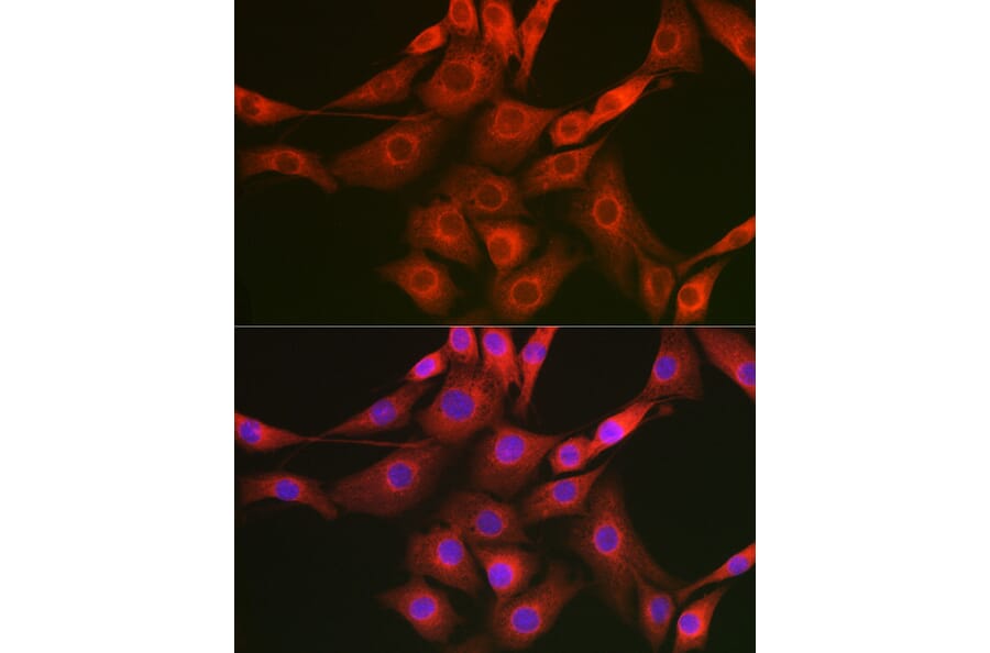 Immunofluorescence - Anti-Raptor Antibody (A87611) - Antibodies.com
