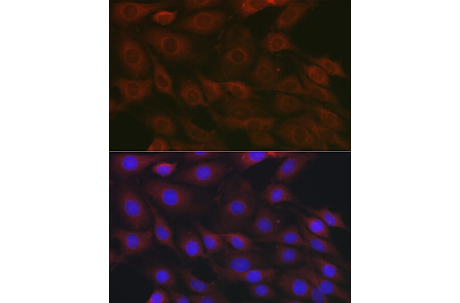 Immunofluorescence - Anti-Raptor Antibody (A87611) - Antibodies.com