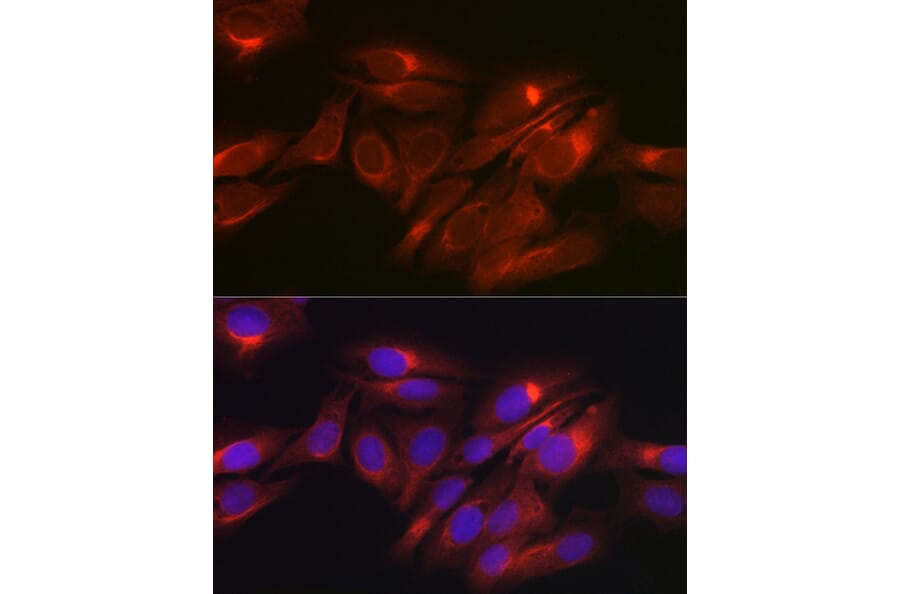 Immunofluorescence - Anti-Raptor Antibody (A87611) - Antibodies.com