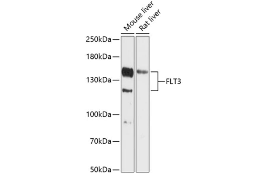 Western Blot - Anti-Flt3 / CD135 Antibody (A87612) - Antibodies.com