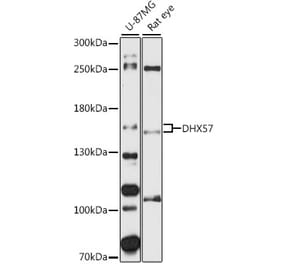Western Blot - Anti-DHX57 Antibody (A87613) - Antibodies.com