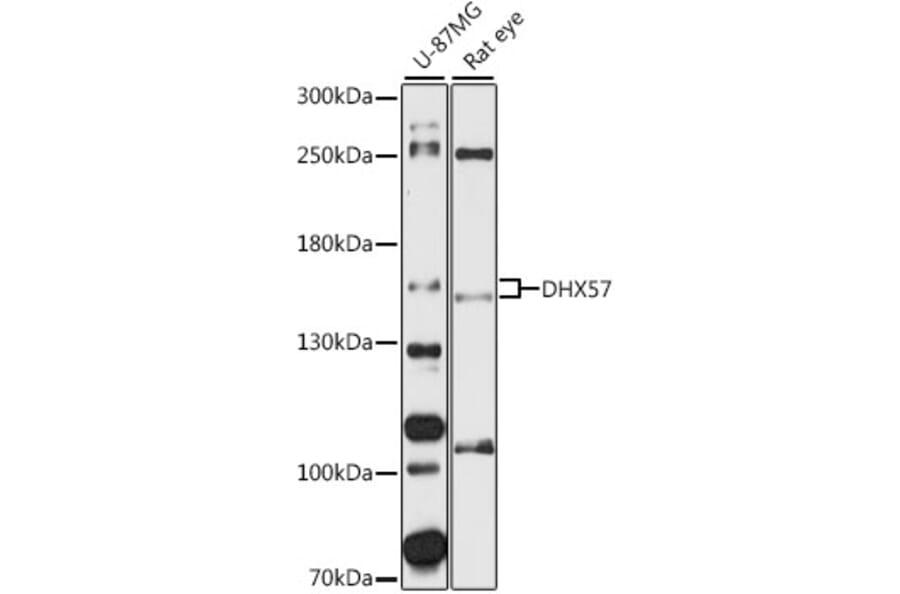 Western Blot - Anti-DHX57 Antibody (A87613) - Antibodies.com