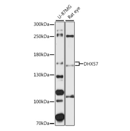 Western Blot - Anti-DHX57 Antibody (A87613) - Antibodies.com