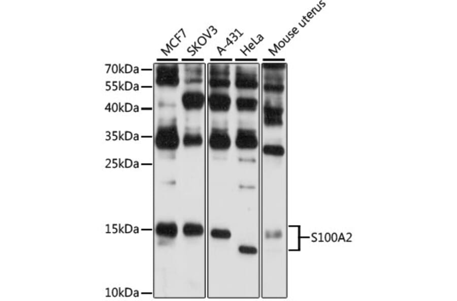 Western Blot - Anti-S100 alpha 2/S100A2 Antibody (A87614) - Antibodies.com