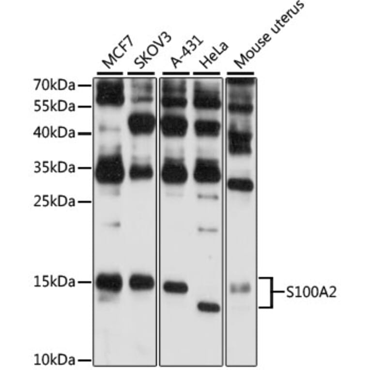 Western Blot - Anti-S100 alpha 2/S100A2 Antibody (A87614) - Antibodies.com