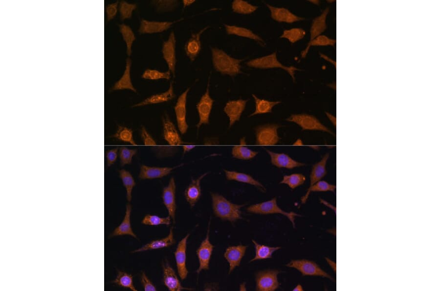 Immunofluorescence - Anti-PDE6D Antibody (A87615) - Antibodies.com