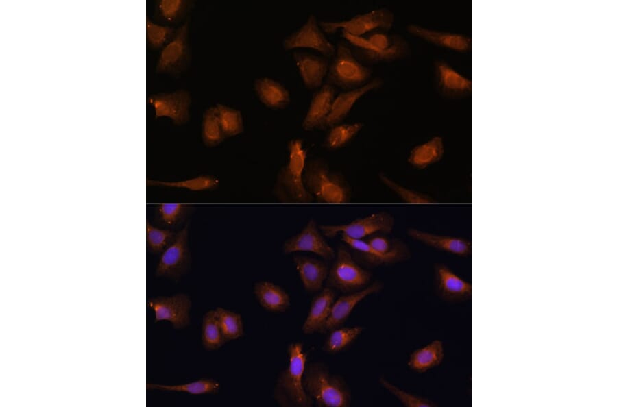 Immunofluorescence - Anti-PDE6D Antibody (A87615) - Antibodies.com