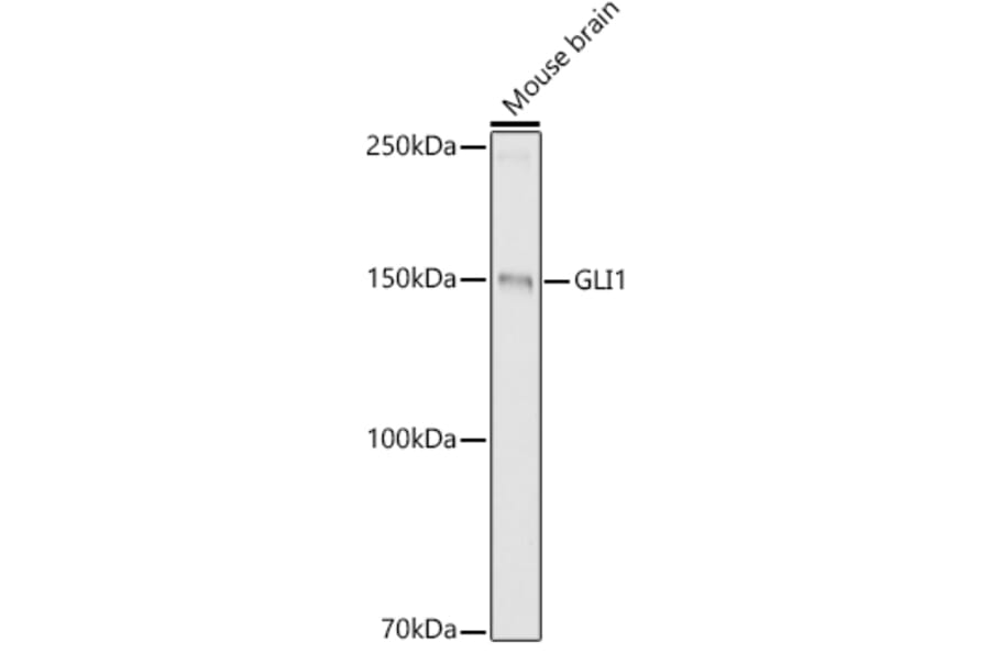 Western Blot - Anti-Gli1 Antibody (A87616) - Antibodies.com
