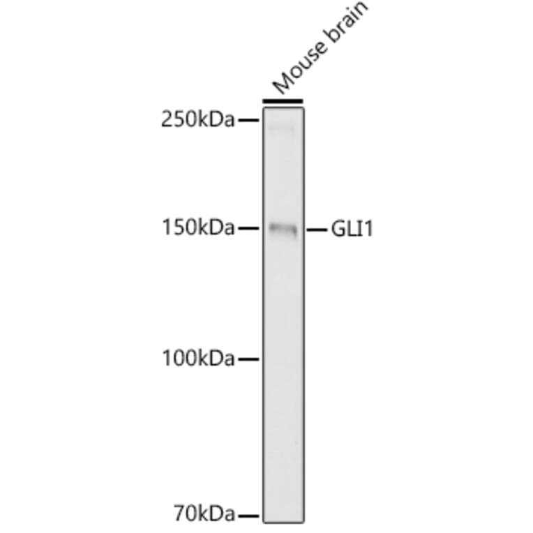 Western Blot - Anti-Gli1 Antibody (A87616) - Antibodies.com