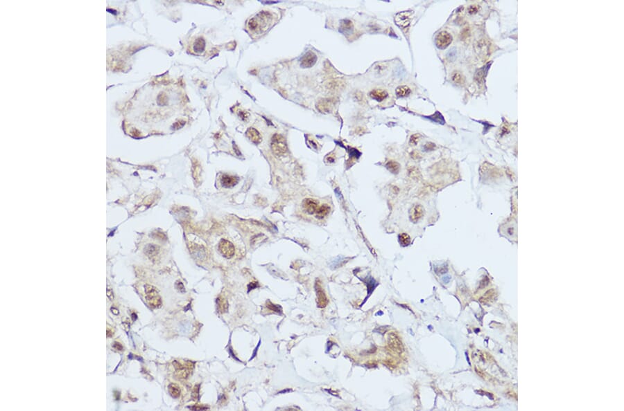 Immunohistochemistry - Anti-Gli1 Antibody (A87616) - Antibodies.com